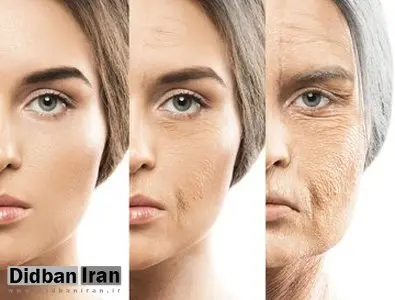 کمبود این ویتامینها باعث پیری زودرس میشود