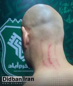 ادعای باشگاه استقلال: مربی ما را کتک زدند!+عکس