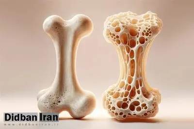 ویتامین‌های مفید برای تقویت استخوان