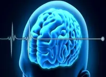 راه‌اندازی واحد شناسایی مرگ مغزی در کشور