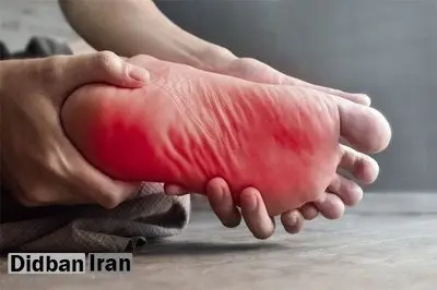 داغی کف پا نشانه چیست؟/ این علائم را جدی بگیرید