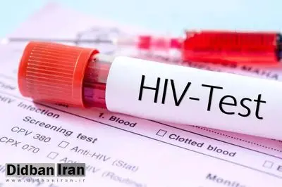 پیشرفت مهم در مسیر درمان «HIV» که پژوهشگران را شگفت‌زده کرد