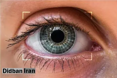 تغییر رنگ چشم؛ یک جراحی زیبایی پرطرفدار