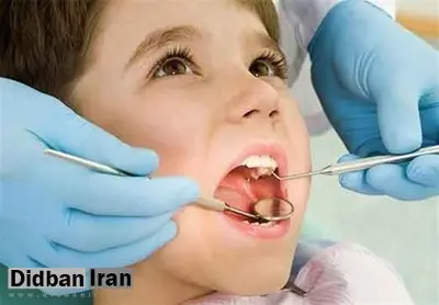 قطره آهن باعث پوسیدگی دندان کودکان میشود؟