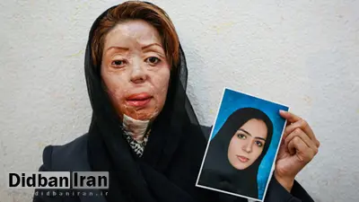 پرونده قربانیان اسیدپاشی های اصفهان مختومه شد