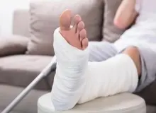 ساخت بانداژ پیزوالکتریک جدیدی که استخوان‌های ترک‌خورده را سریع‌تر ترمیم می‌کند