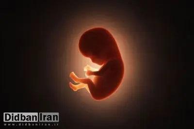 اعتراض بیش از ۵۰ تشکل علمی پزشکی به دستورالعمل غربالگری ناهنجاری جنین/ دستورالعمل وزارت بهداشت برخلاف منابع علمی معتبر است