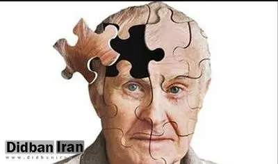 نشانه‌ای از زوال عقل آینده ممکن است در شکل مغز شما پنهان باشد