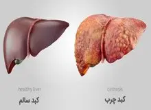 خوراکی‌های مفید و مضر برای کبد را بشناسید+اسامی 