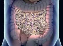 کشف یک باکتری در روده که وزن بدن را کاهش می‌دهد