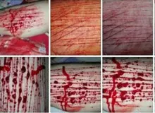 گزارش "دیده بان ایران" از گسترش "خون بازی" در مدارس دخترانه تهران/ دو واحد پاس کردن «خون بازی» در مدارس تهران