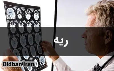 فوق تخصص بیماریهای ریه: در فصل پاییز و زمستان، آنفلوآنزا هم به کرونا اضافه میشود/ PCR در بهترین شرایط میتواند تا ۶۰ درصد مثبت بودن کرونا را نشان بدهد
