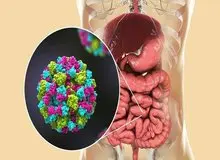 علائم ویروس جدید در امریکا/ پیش‌بینی ۹۰۰ مرگ
