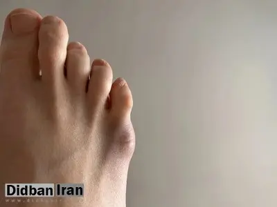 وظیفه بزرگِ انگشت کوچک پا / اگر نباشد چه می‌شود؟