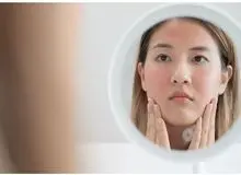 دلایل ایجاد جوش زیرپوستی ؛ روش های درمان پزشکی و خانگی جوش زیرپوستی