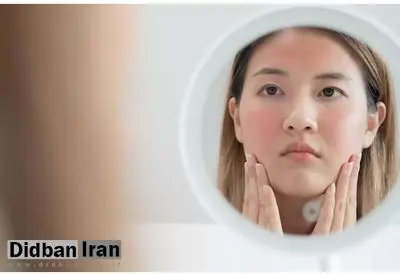 دلایل ایجاد جوش زیرپوستی ؛ روش های درمان پزشکی و خانگی جوش زیرپوستی