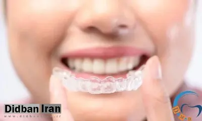 مراحل ارتودنسی دو فک چگونه است؟