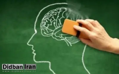 زیاد نخوابید، آلزایمر میگیرید