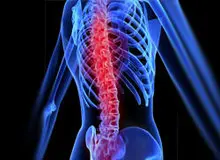 دلیل بروز عفونت در جراحی‌های ستون فقرات