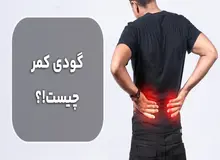 با گودی کمر چه باید کرد؟