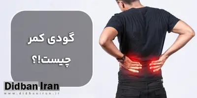 با گودی کمر چه باید کرد؟