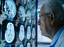 ابداع روشی جدید که می‌تواند زوال عقل را تا ۹ سال زودتر پیش‌بینی کند