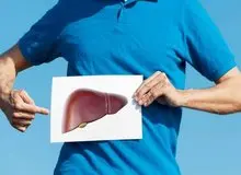 کبد چرب بیشتر در چه افرادی شایع است؟