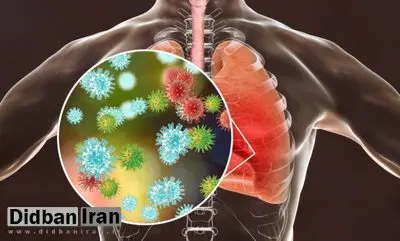 شیوع عفونت‌های قارچی درمان‌ناپذیر با گرمای هوا!