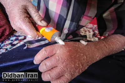 ماجرای رها شدن یک نوزاد پروانه‌ای در بیمارستان