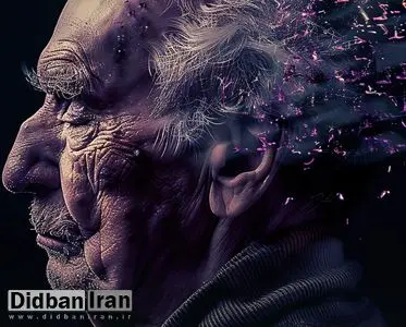 هوش مصنوعی فهم و درمان آلزایمر و پارکینسون را ممکن می‌سازد