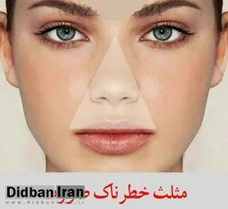 به این جوش های خطرناک دست نزنید