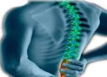 85 درصد مردم به نوعی دچار کمردرد و اختلال ستون فقرات هستند