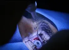 حمله ارگان اطلاع  رسانی نزدیک به سپاه به وزیر بهداشت دوره روحانی: ردپای یک پزشک و مقام سابق مشهور در انجام جراحی ممنوعه/ اعزام بیماران از ایران به عمان برای تغییر رنگ چشم