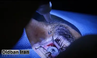 حمله ارگان اطلاع  رسانی نزدیک به سپاه به وزیر بهداشت دوره روحانی: ردپای یک پزشک و مقام سابق مشهور در انجام جراحی ممنوعه/ اعزام بیماران از ایران به عمان برای تغییر رنگ چشم