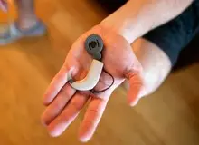 کاشت حلزون شنوایی رایگان شد