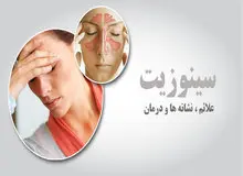 راه‌های ساده برای درمان سینوزیت