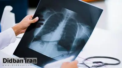 ژاپنیها استفاده از هوش مصنوعی را برای تعیین سن بیولوژیکی و طول عمر انسان آغاز کردند
