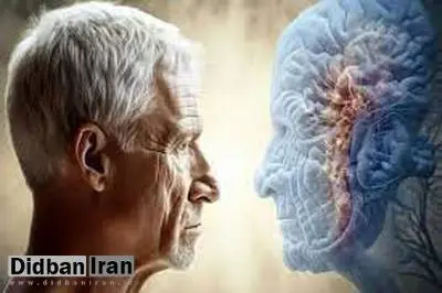 رژیم غذایی می‌تواند تا حدی ‌پیری مغز را معکوس کند