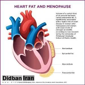 ارتباط چربی دور قلب با افزایش خطر ابتلا به بیماری قلبی در زنان