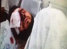 هوادار آسیب‌دیده پرسپولیس: چه کسی جواب دخترم را می‌دهد؟+ عکس