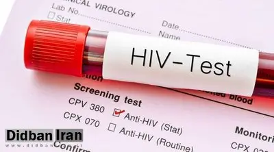 بهترین زمان برای آزمایش HIV چند ماه بعد از رابطه جنسی می باشد؟