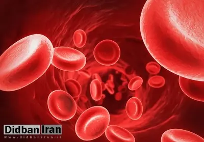 چگونه کم خونی را درمان کنیم؟