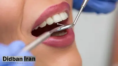 انقلابی در دندان‌پزشکی؛ یک ژل پروتئینی جدید مینای دندان را ترمیم و بازسازی می‌کند