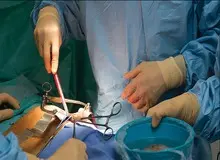 پیوند کلیه به اتباع خارجی ممنوع شد