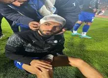 سر زبیر قبل از بازی شکست!
