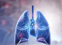 تأیید نخستین دارو برای بیماری مزمن ریوی