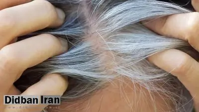 مطالعه جدید ارتباط پنهان میان سفیدی مو و سرطان را نشان میدهد