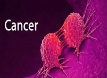 ۳۰ تا ۵۰ درصد سرطان‌ها قابل پیشگیری است