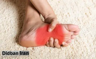 داغی و سوزش کف پا نشانه چیست؟