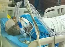 اولین اظهارات روحانی زخمی حادثه مترو شهرری؛ موضوع امر به معروف صحت ندارد/ اصلا ضارب را ندیدم